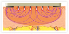 Energy penetrates the skin