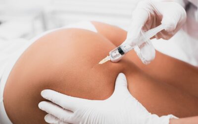 Transform Your Glutes with Sculptra Injections at Parfaire