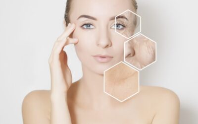 Fractora: Total Skin Restoration