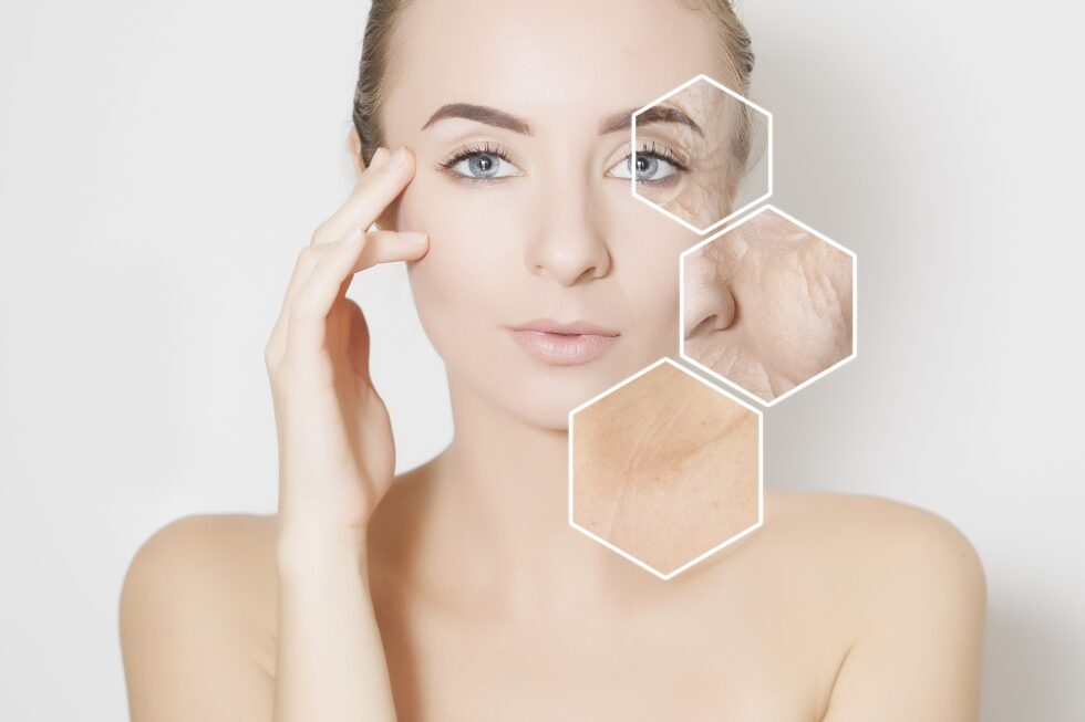 Fractora: Total Skin Restoration