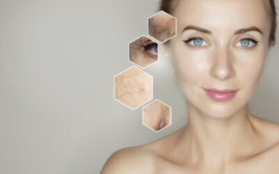 The Power of Microneedling: Hyaluronic Acid & PRP for Youthful Skin