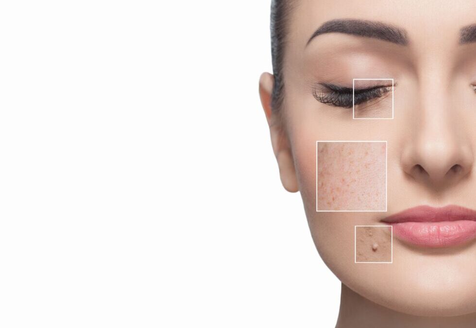 A message from Parfaire: The Goldilocks Solution to Dark Spots on Your Skin