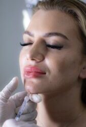 Dermal Fillers Can Be Reversed With Hylenex