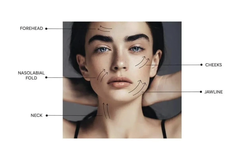 THREAD LIFT TREATMENT