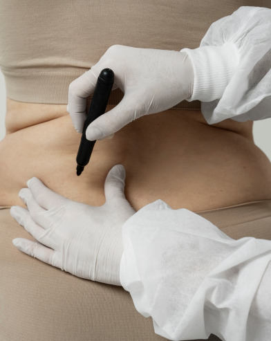 How Does Liposuction Work