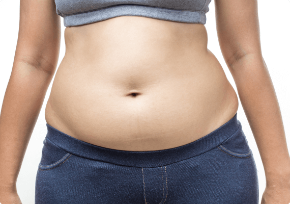 TUMESCENT LIPOSUCTION TUMESCENT LIPOSUCTION