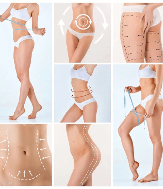 TUMESCENT LIPOSUCTION TUMESCENT LIPOSUCTION