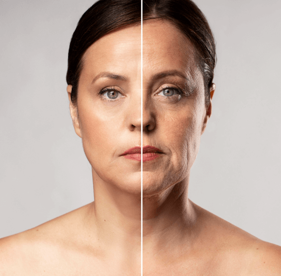 ENDOLIFT-Treatment-Feel-Like ENDOLIFT-Treatment-Feel-Like