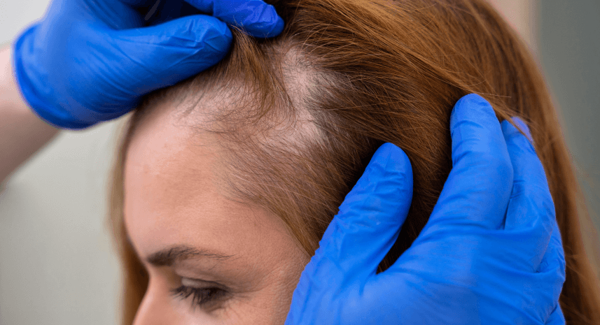 woman-getting-hair-loss-treatment-clinic