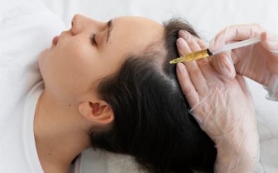 PRP Injections For Hair Loss: What You Need To Know