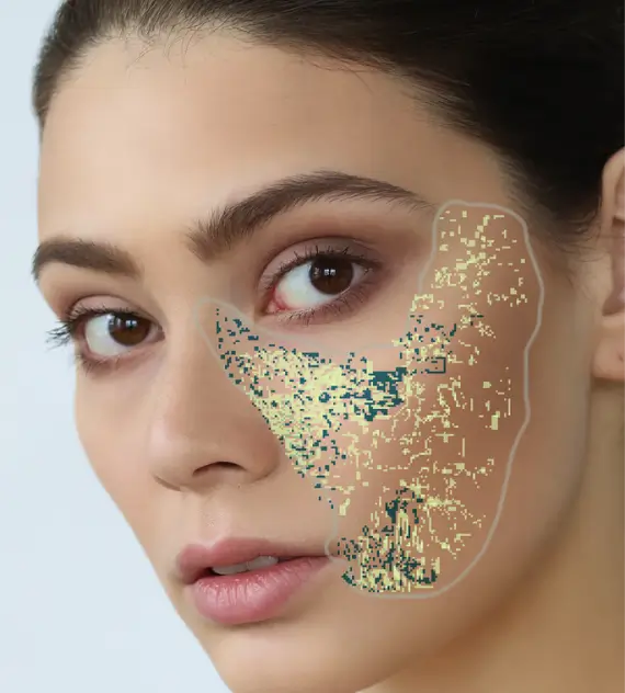Benefits Visia Scan AI Facial Analysis Image Benefits Visia Scan AI Facial Analysis Image