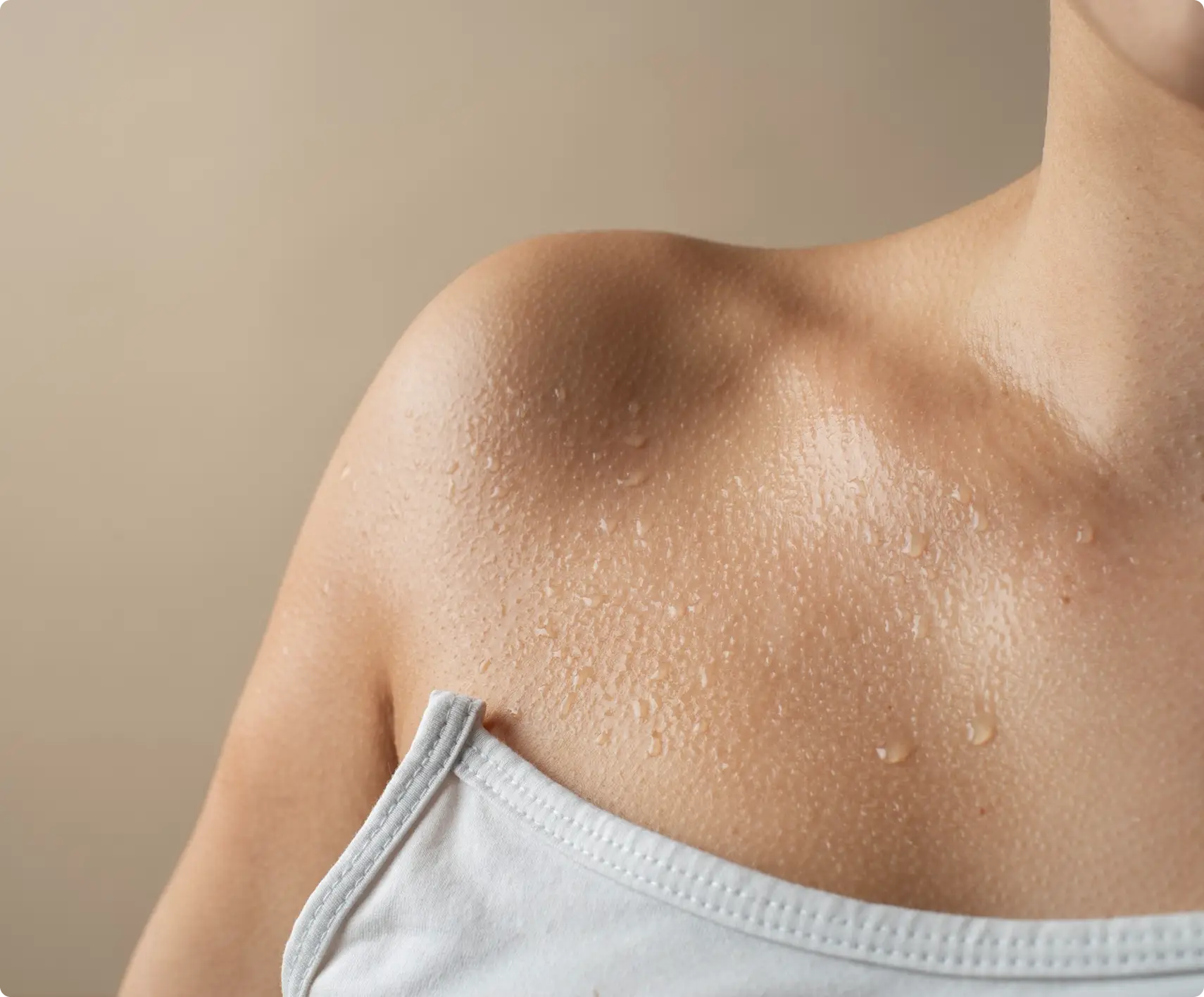 Excessive Sweating