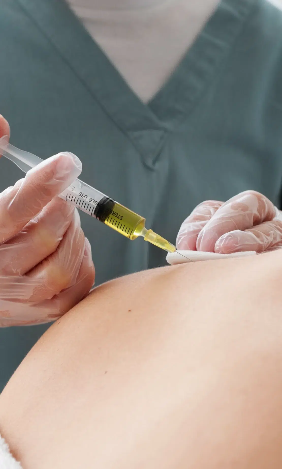 Treatment for Hyperhidrosis
