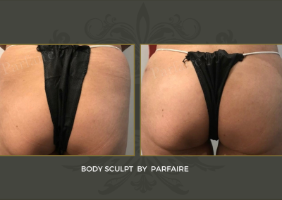 Body sculpt