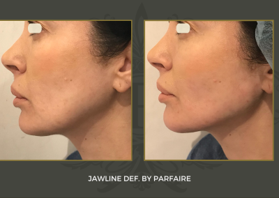 Jawline 2