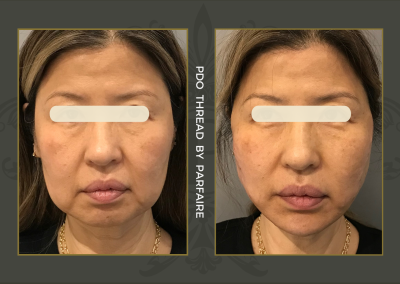 PDO_FILLER