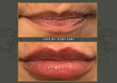 lips (2)