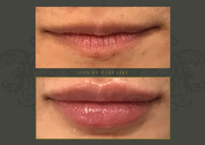 lips (3)